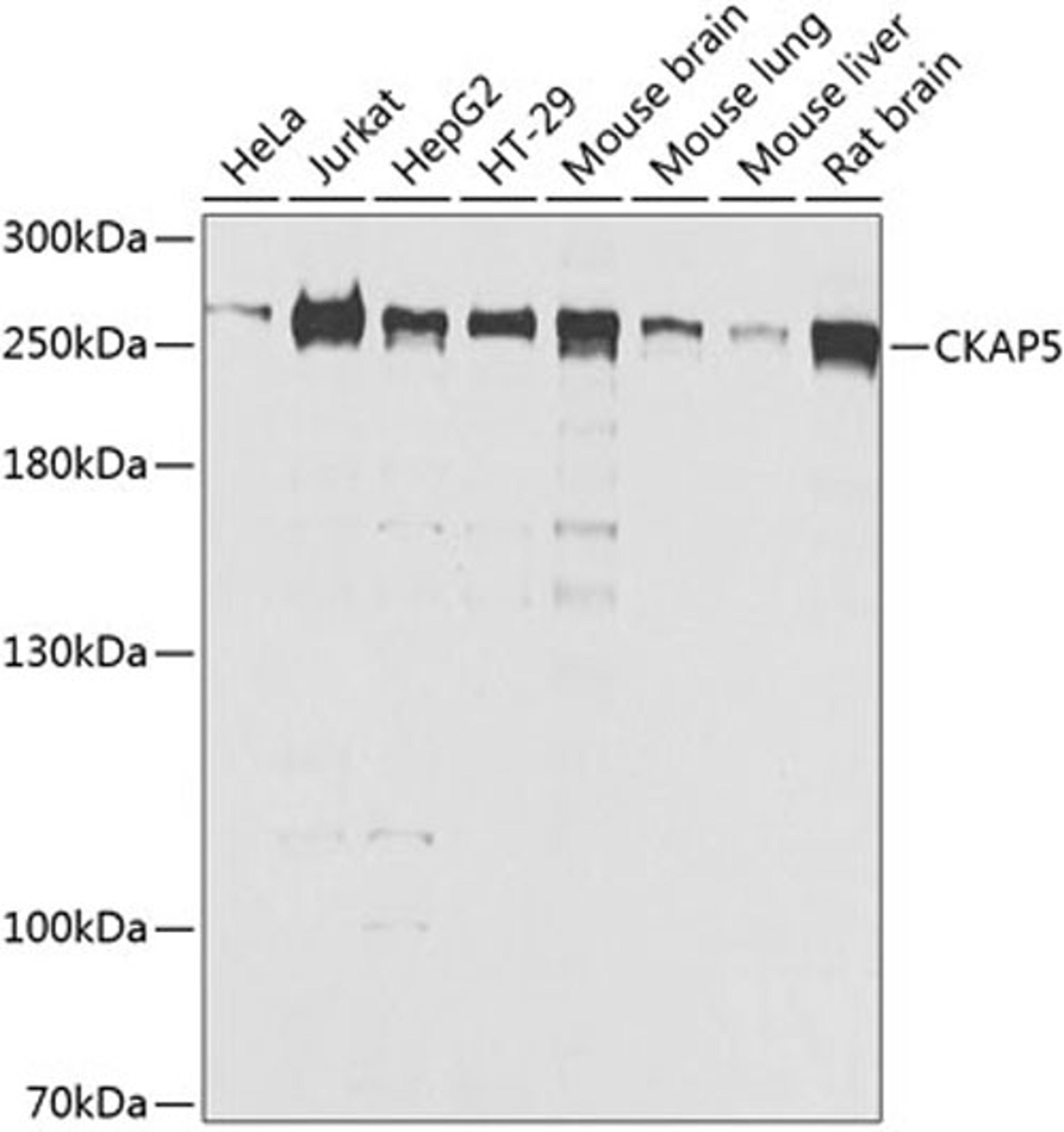 Western blot - CKAP5 antibody (A8532)