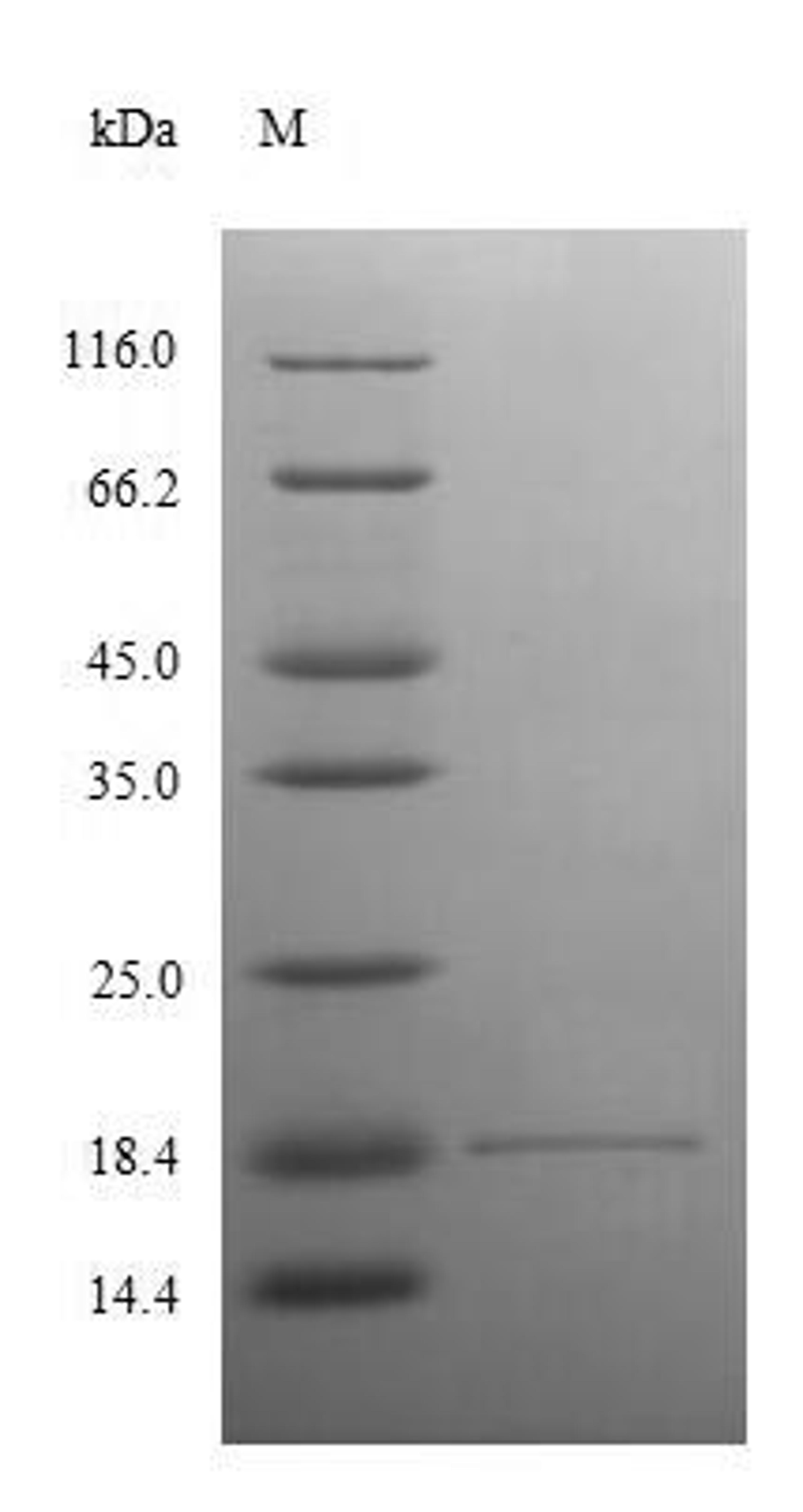 (Tris-Glycine gel) Discontinuous SDS-PAGE (reduced) with 5% enrichment gel and 15% separation gel.