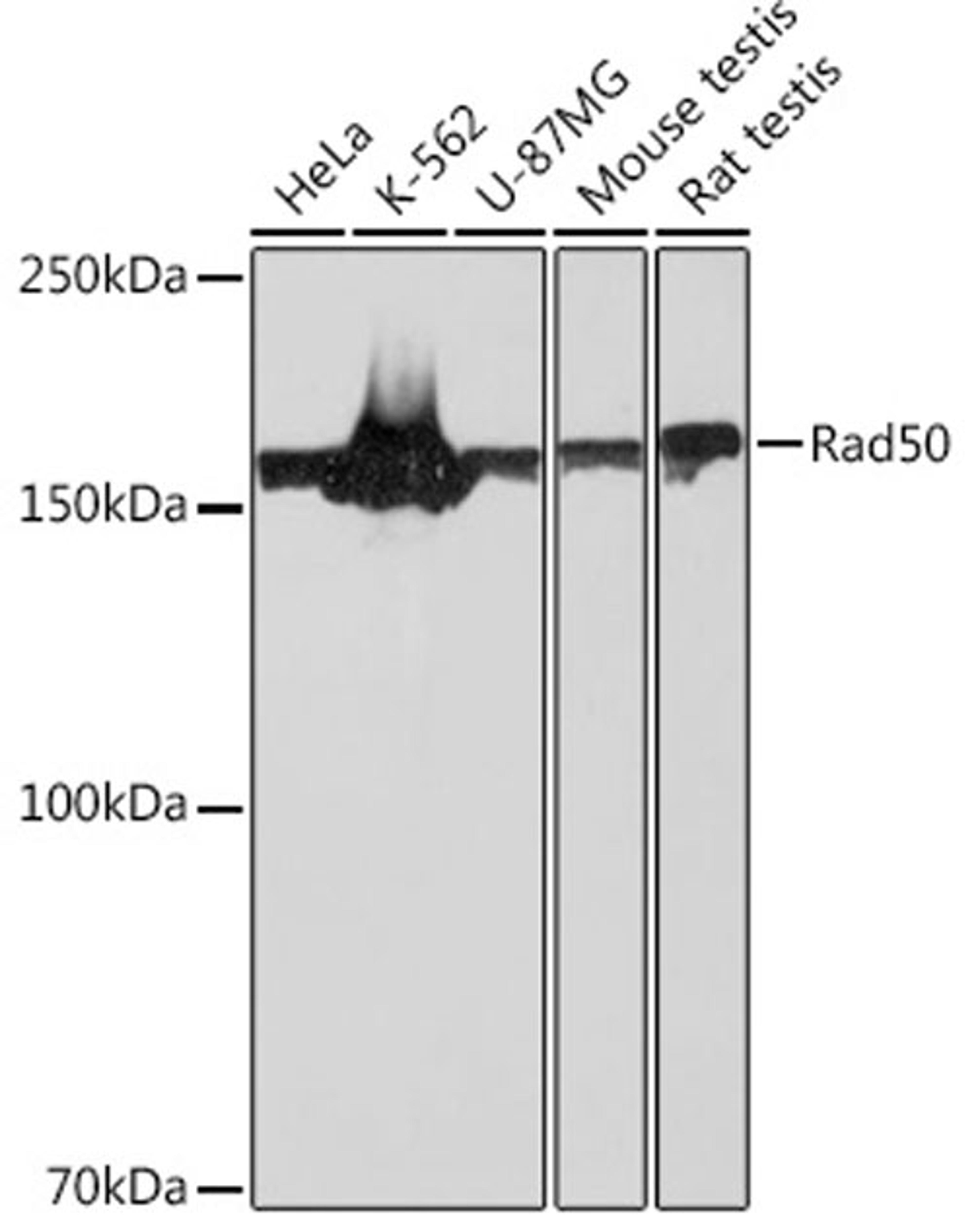 Western blot - Rad50 Rabbit mAb (A3869)