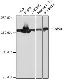 Western blot - Rad50 Rabbit mAb (A3869)