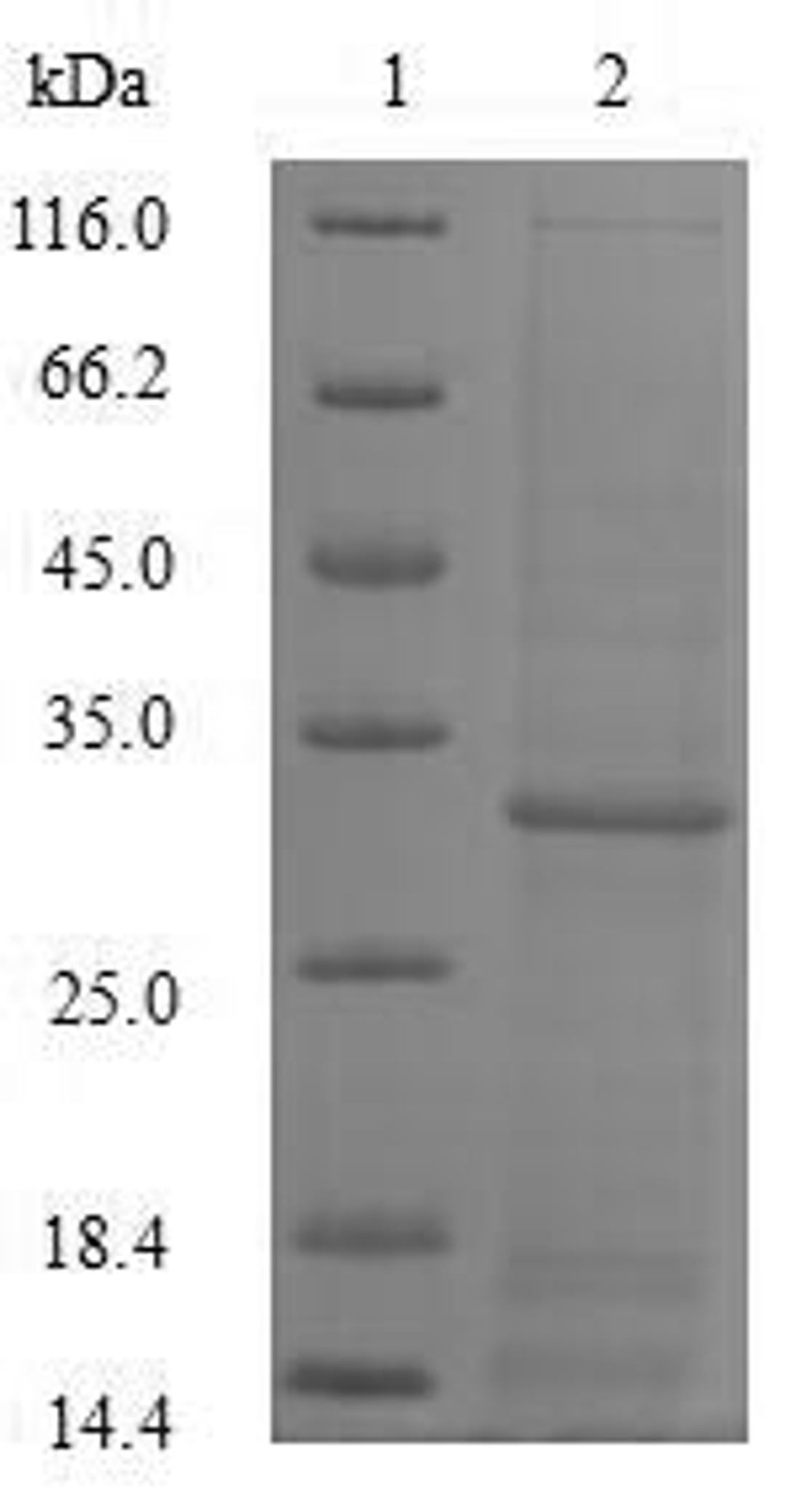 (Tris-Glycine gel) Discontinuous SDS-PAGE (reduced) with 5% enrichment gel and 15% separation gel.