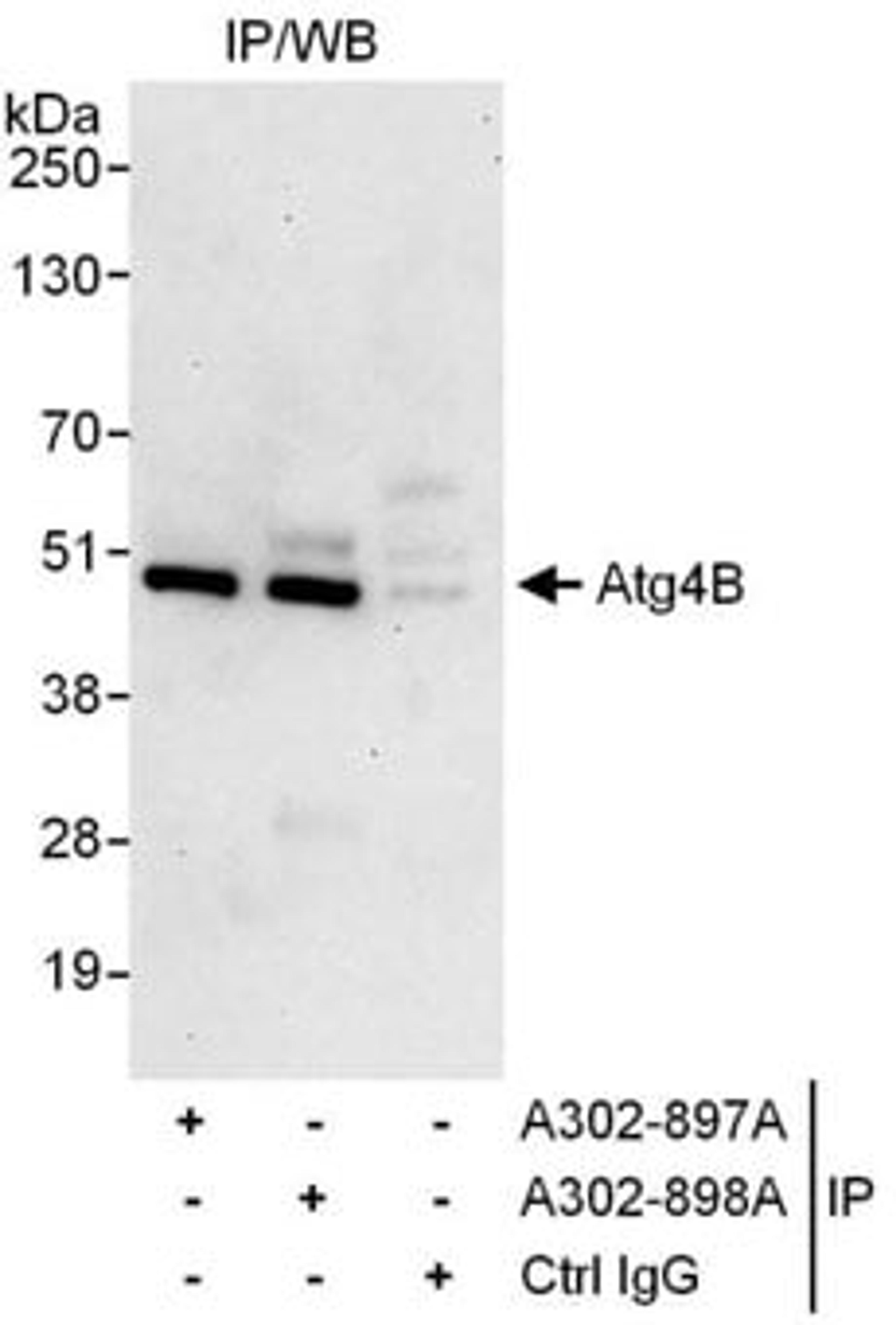 Detection of human Atg4B by western blot of immunoprecipitates.