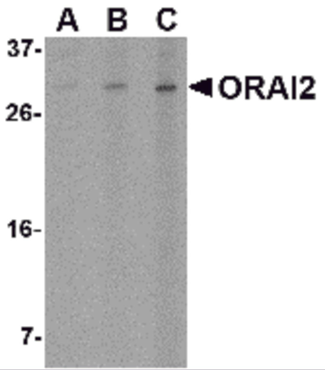 Western blot analysis of ORAI2 in Jurkat cell lysate with ORAI2 antibody at (A) 1, (B) 2 and (C) 4 &#956;g/mL.