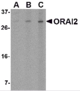 Western blot analysis of ORAI2 in Jurkat cell lysate with ORAI2 antibody at (A) 1, (B) 2 and (C) 4 &#956;g/mL.