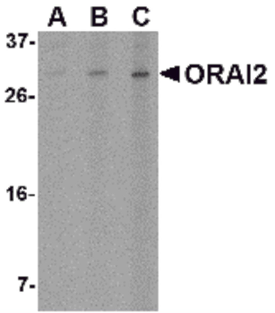 Western blot analysis of ORAI2 in Jurkat cell lysate with ORAI2 antibody at (A) 1, (B) 2 and (C) 4 μg/mL.