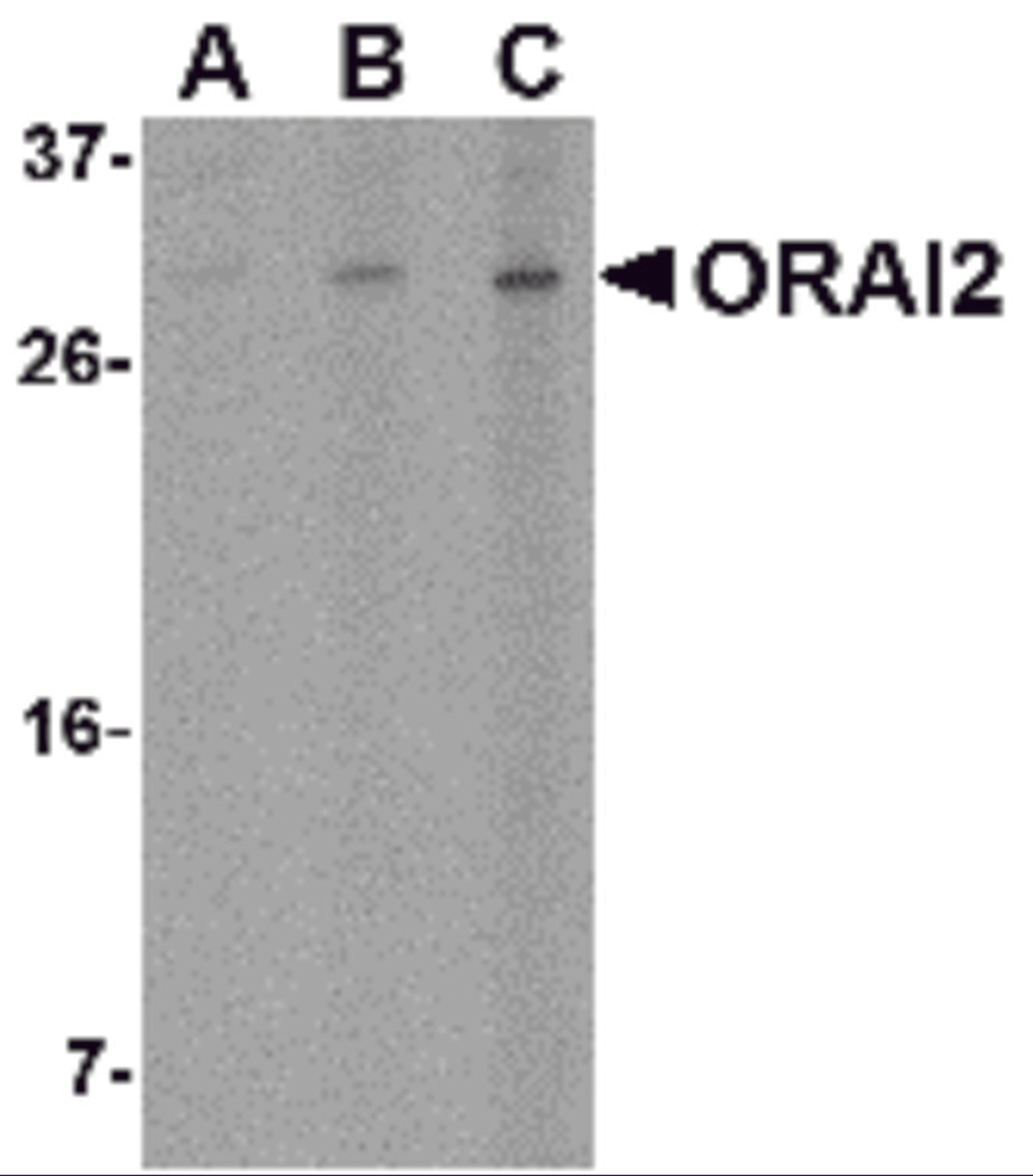 Western blot analysis of ORAI2 in Jurkat cell lysate with ORAI2 antibody at (A) 1, (B) 2 and (C) 4 μg/mL.