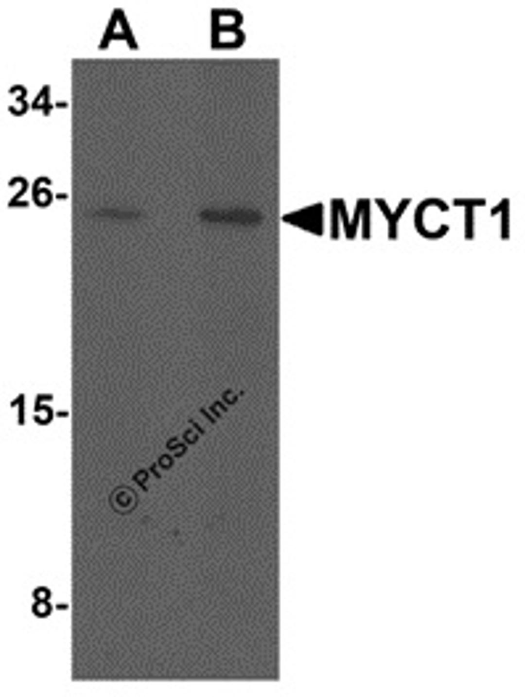 Western blot analysis of MYCT1 in rat lung tissue lysate with MYCT1 antibody at (A) 1 and (B) 2 μg/mL.