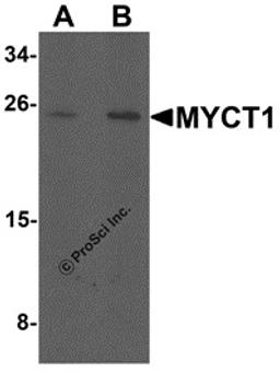 Western blot analysis of MYCT1 in rat lung tissue lysate with MYCT1 antibody at (A) 1 and (B) 2 μg/mL.