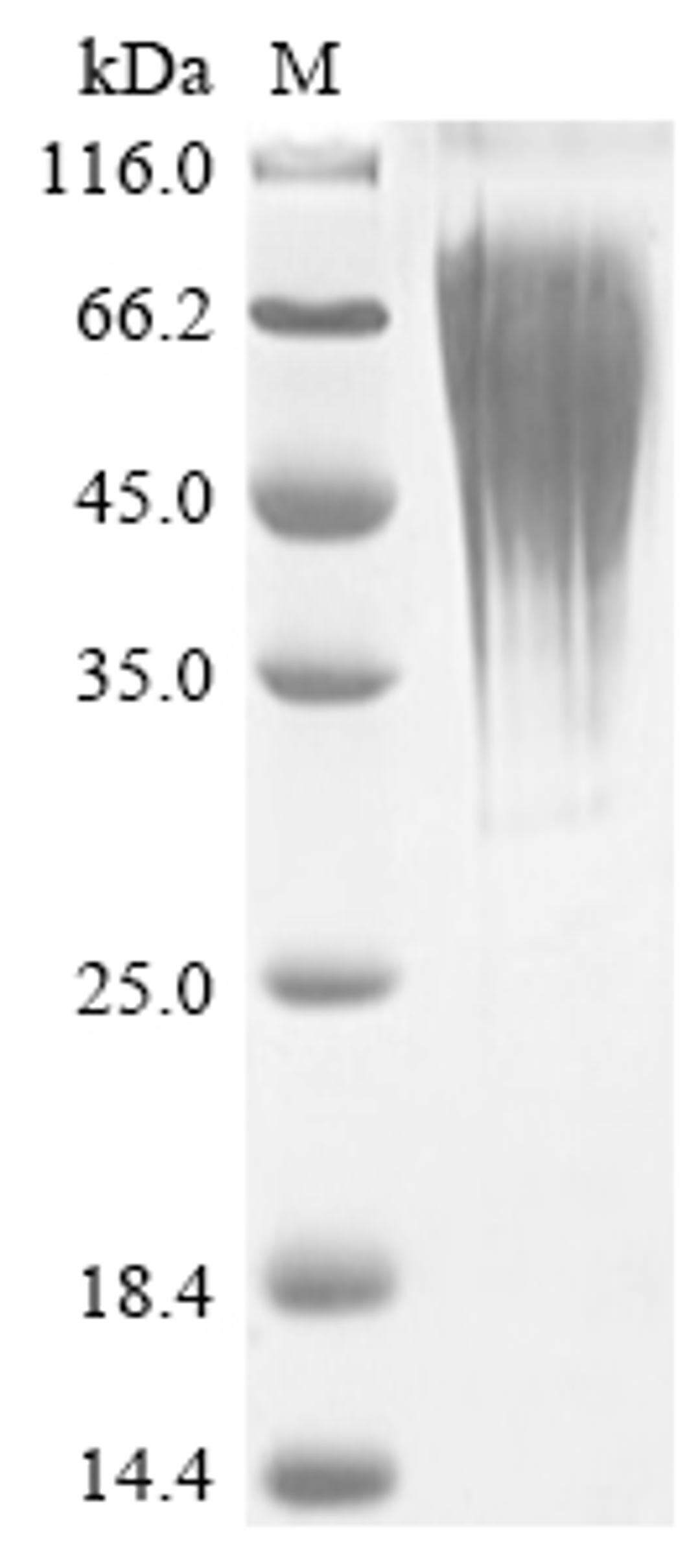 (Tris-Glycine gel) Discontinuous SDS-PAGE (reduced) with 5% enrichment gel and 15% separation gel.