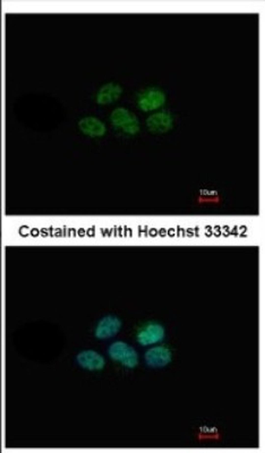 Immunocytochemistry/Immunofluorescence: NR1D1 Antibody [NBP2-19574] - Immunofluorescence analysis of paraformaldehyde-fixed A431, using antibody at 1:500 dilution.