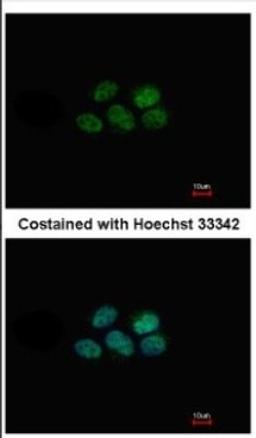 Immunocytochemistry/Immunofluorescence: NR1D1 Antibody [NBP2-19574] - Immunofluorescence analysis of paraformaldehyde-fixed A431, using antibody at 1:500 dilution.