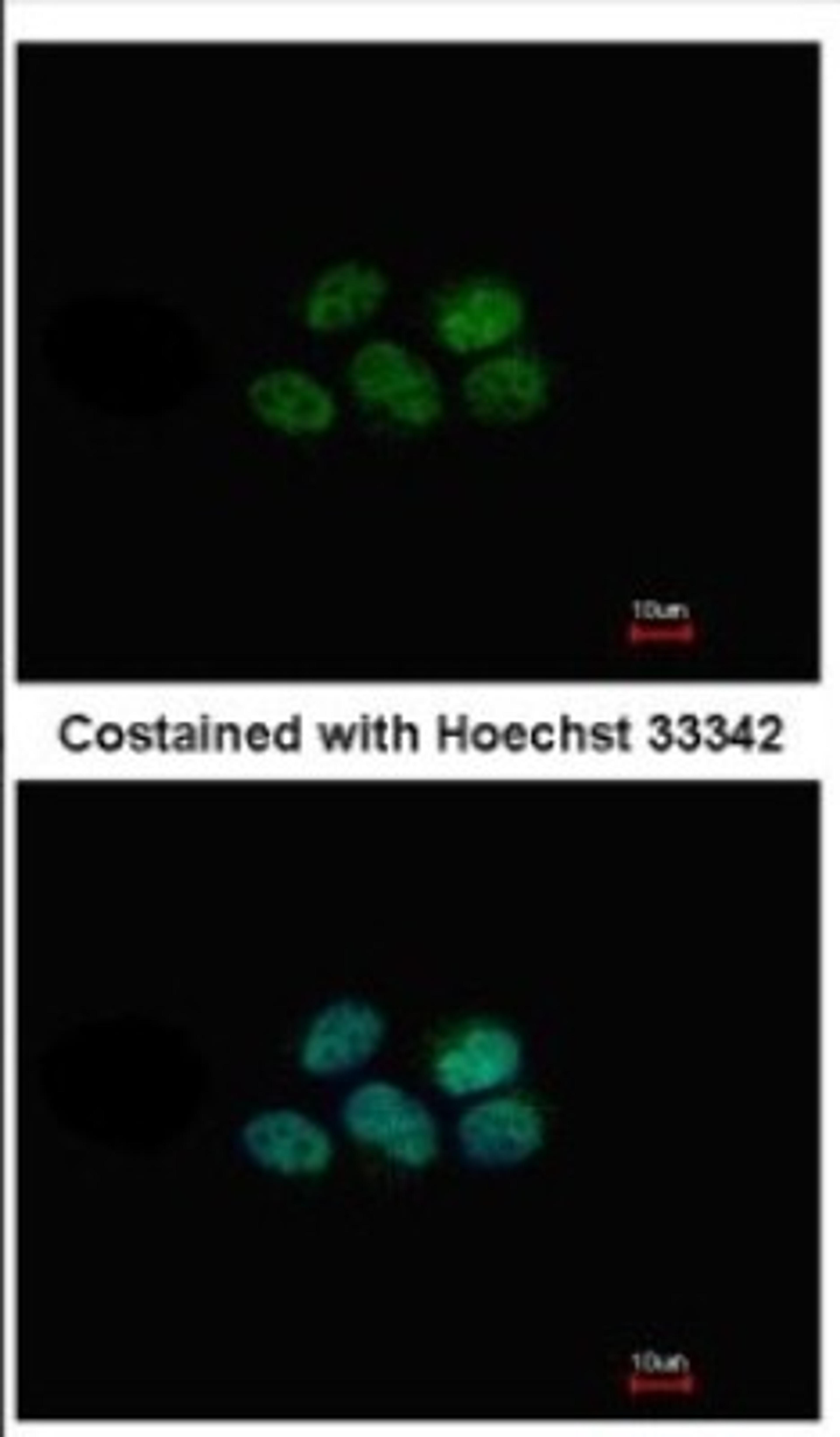 Immunocytochemistry/Immunofluorescence: NR1D1 Antibody [NBP2-19574] - Immunofluorescence analysis of paraformaldehyde-fixed A431, using antibody at 1:500 dilution.