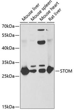 Western blot - STOM antibody (A6372)