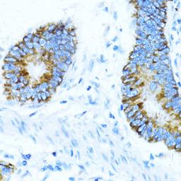 Immunohistochemistry  - NOX1 antibody (A11966)