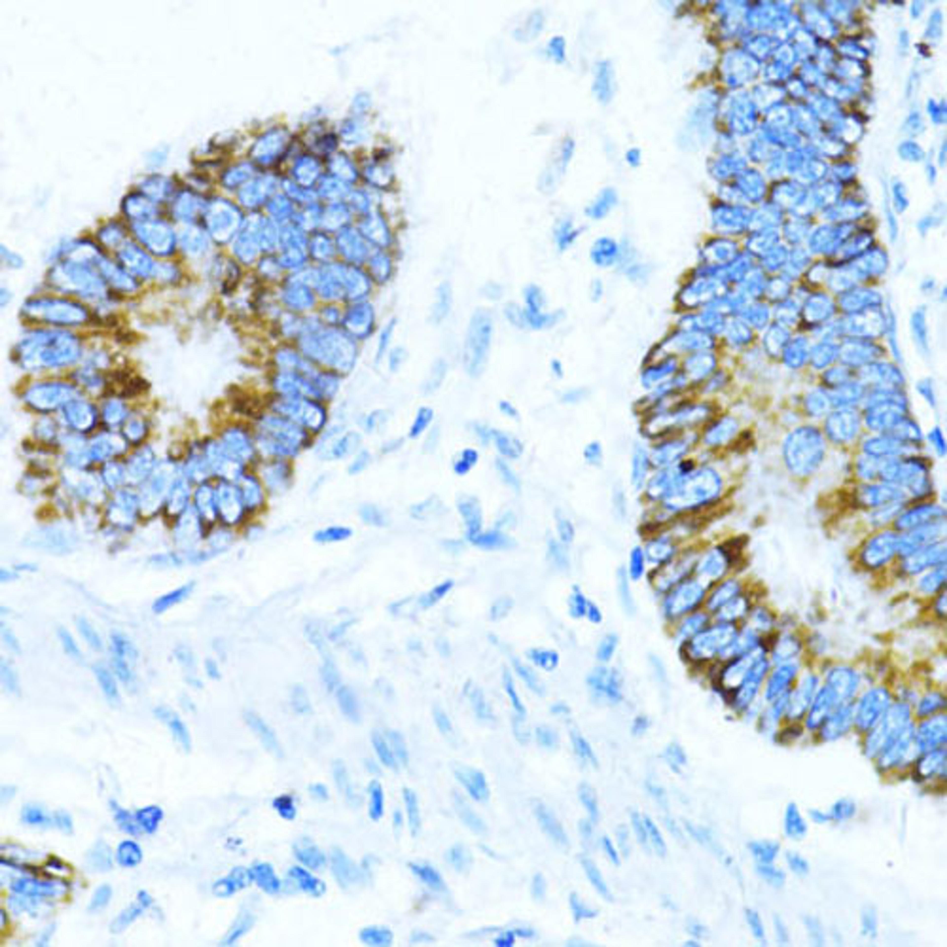 Immunohistochemistry - NOX1 antibody (A11966)