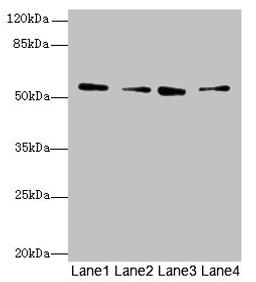 Western blot. All lanes: ERO1B antibody at 3.2µg/ml. Lane 1: MCF-7 whole cell lysate. Lane 2: U251 whole cell lysate. Lane 3: Mouse liver tissue. Lane 4: U87 whole cell lysate. Secondary. Goat polyclonal to rabbit IgG at 1/10000 dilution. Predicted band size: 54, 17 kDa. Observed band size: 54 kDa