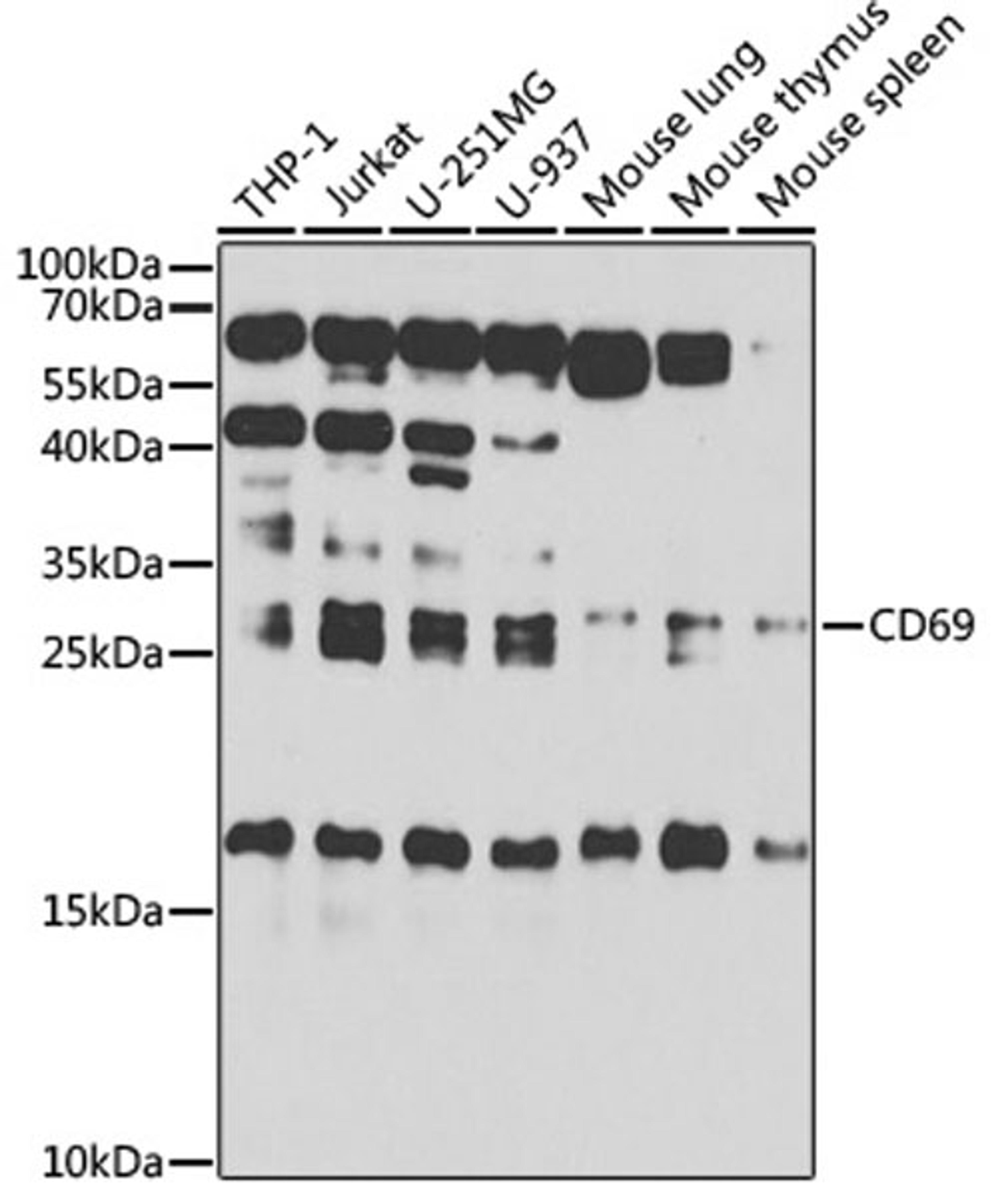 Western blot - CD69 antibody (A2045)