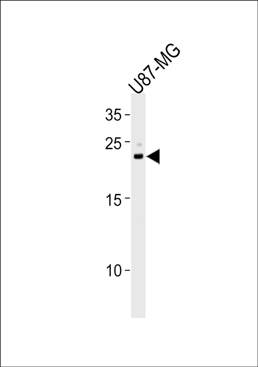 Western blot analysis in U87-MG cell line lysates (35ug/lane).