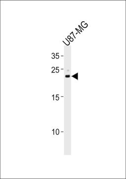 Western blot analysis in U87-MG cell line lysates (35ug/lane).