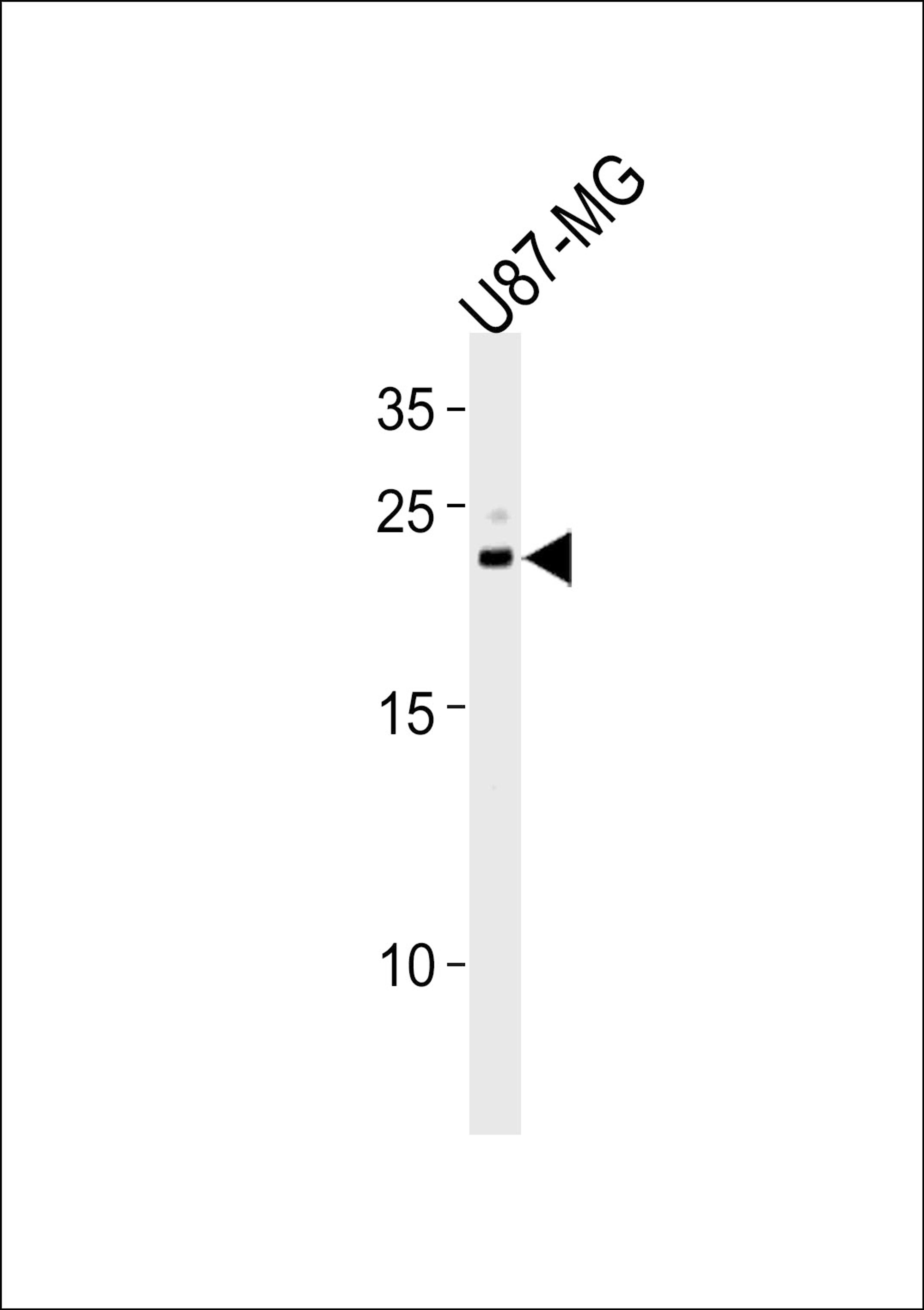 Western blot analysis in U87-MG cell line lysates (35ug/lane).