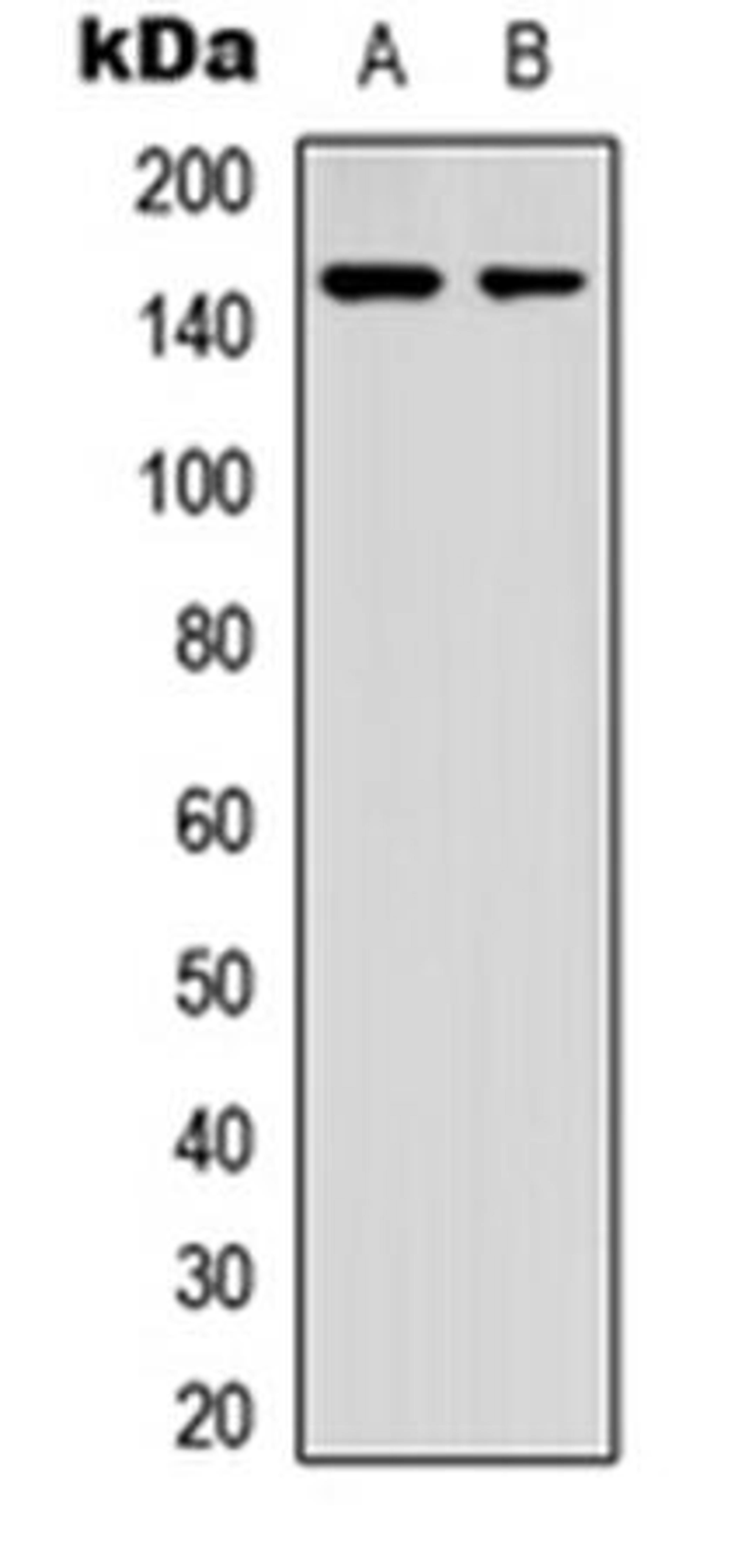 Western blot analysis of HeLa (Lane1), Jurkat (Lane2) whole cell using GAK antibody