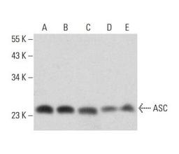 Western blot analysis of ASC expression