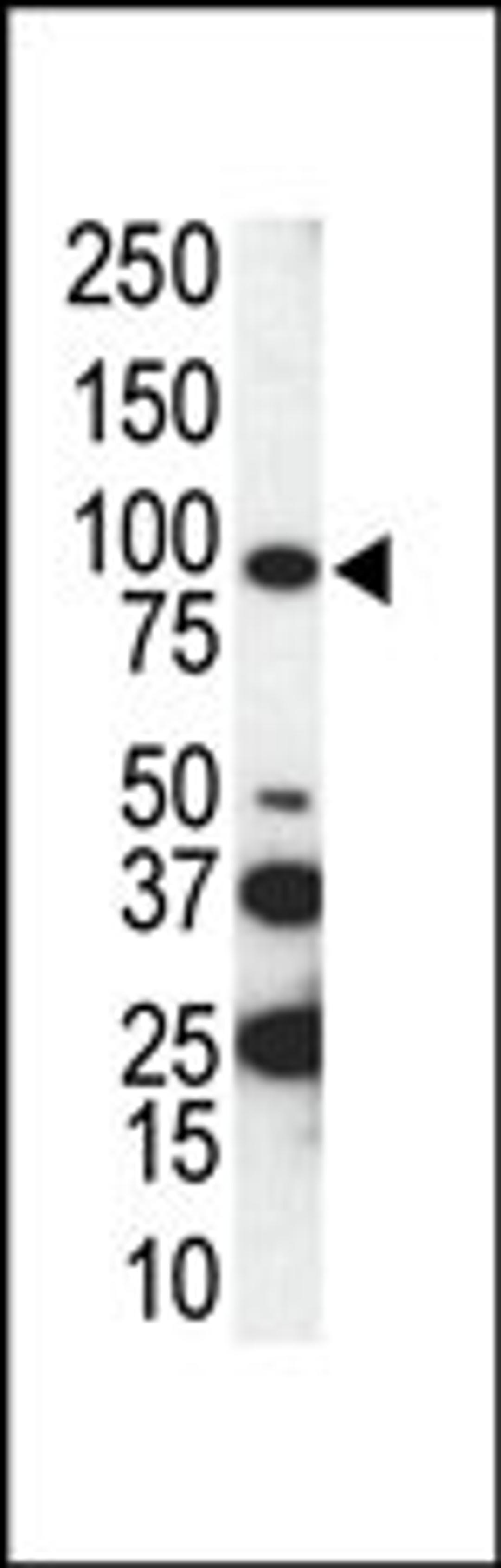 Western blot analysis of anti-AXL C-term Pab in SKBR3 cell lysate