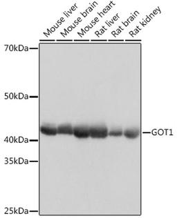 Western blot - GOT1  Rabbit mAb (A11363)