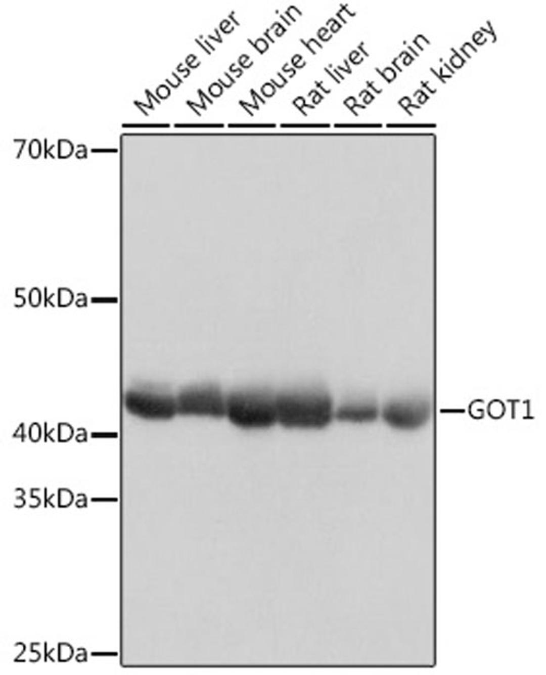 Western blot - GOT1 Rabbit mAb (A11363)