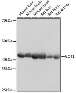 Western blot - GOT1 Rabbit mAb (A11363)