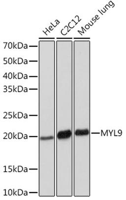 Western blot - MYL9 Rabbit mAb (A8738)