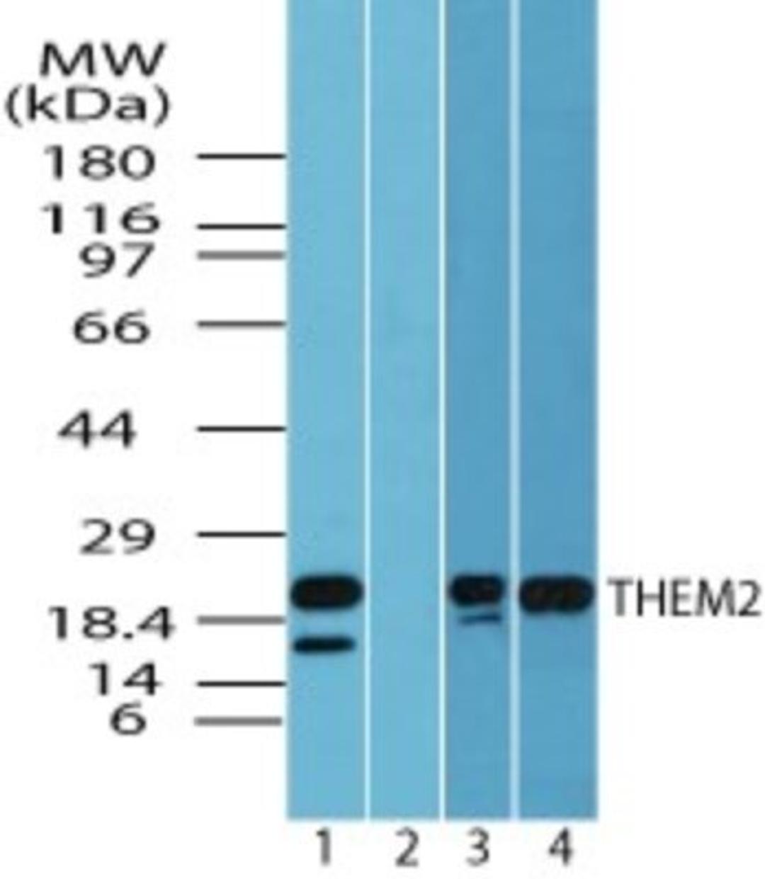 Western Blot: THEM2 Antibody [NBP2-24609] - Analysis of THEM2 in human kidney lysate in the 1) absence and 2) presence of immunizing peptide 3) mouse kidney and 4) rat kidney using this antibody. 5 ug/ml, 0.25 ug/ml and 0.25 ug/ml, respectively.