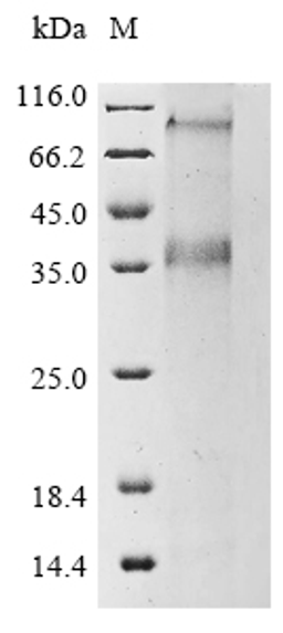 (Tris-Glycine gel) Discontinuous SDS-PAGE (reduced) with 5% enrichment gel and 15% separation gel.