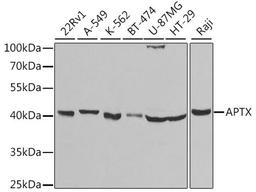 Western blot - APTX antibody (A5364)