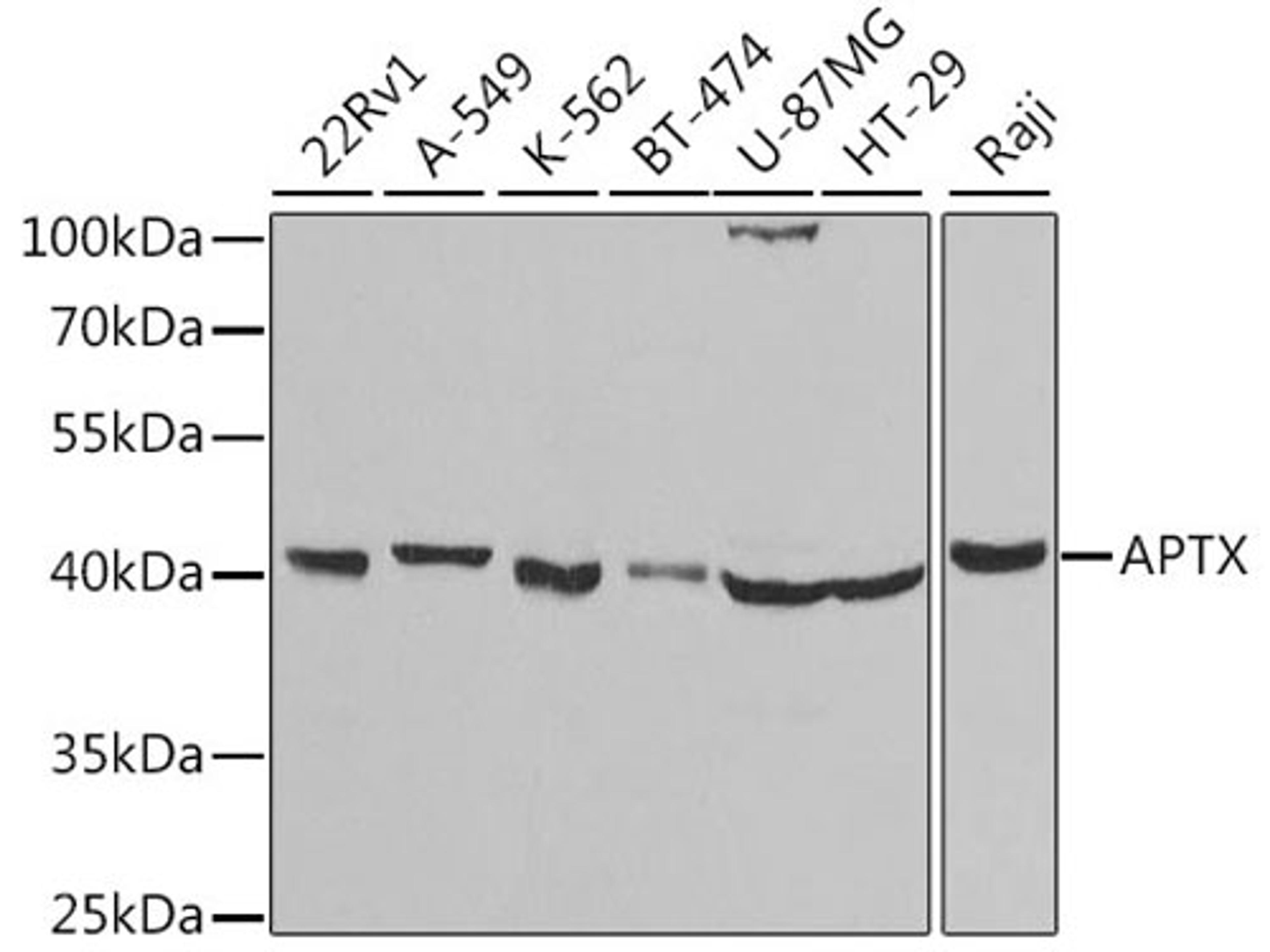 Western blot - APTX antibody (A5364)