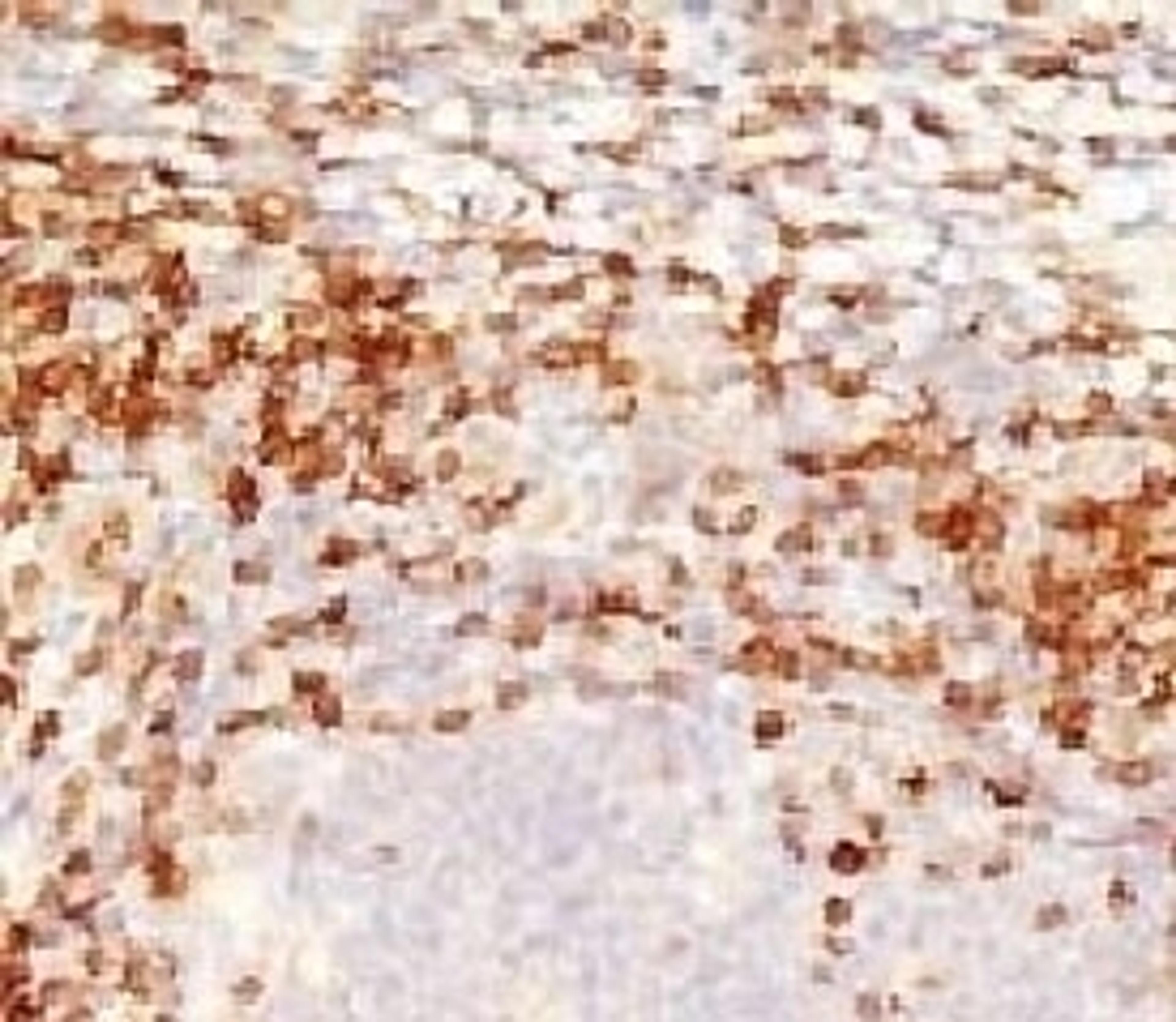 IHC testing of human tonsil stained with CD5 antibody (CLDA5-1)