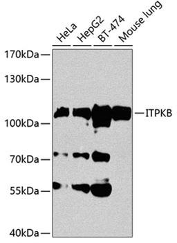 Western blot - ITPKB antibody (A3929)