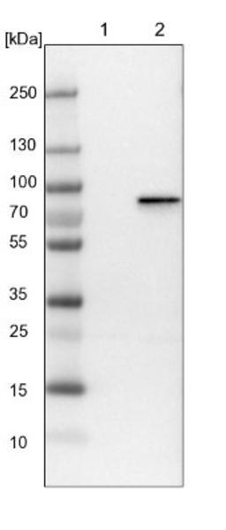 Western Blot: Plakophilin 1 Antibody [NBP1-90042] - Lane 1: NIH-3T3 cell lysate (Mouse embryonic fibroblast cells)<br/>Lane 2: NBT-II cell lysate (Rat Wistar bladder tumour cells)