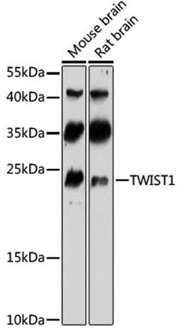Western blot - Twist antibody (A3237)