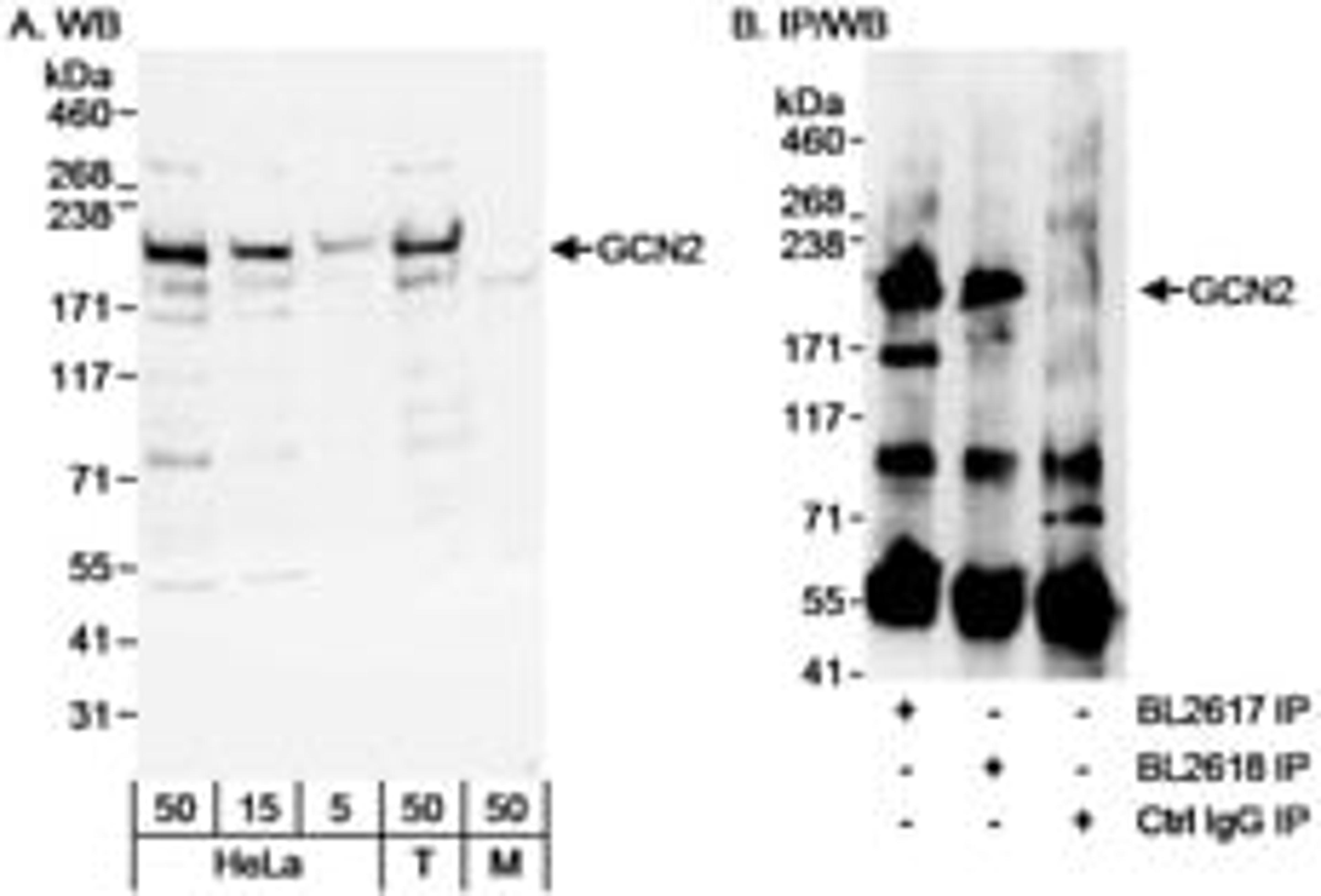 Detection of human GCN2 by western blot and immunoprecipitation.