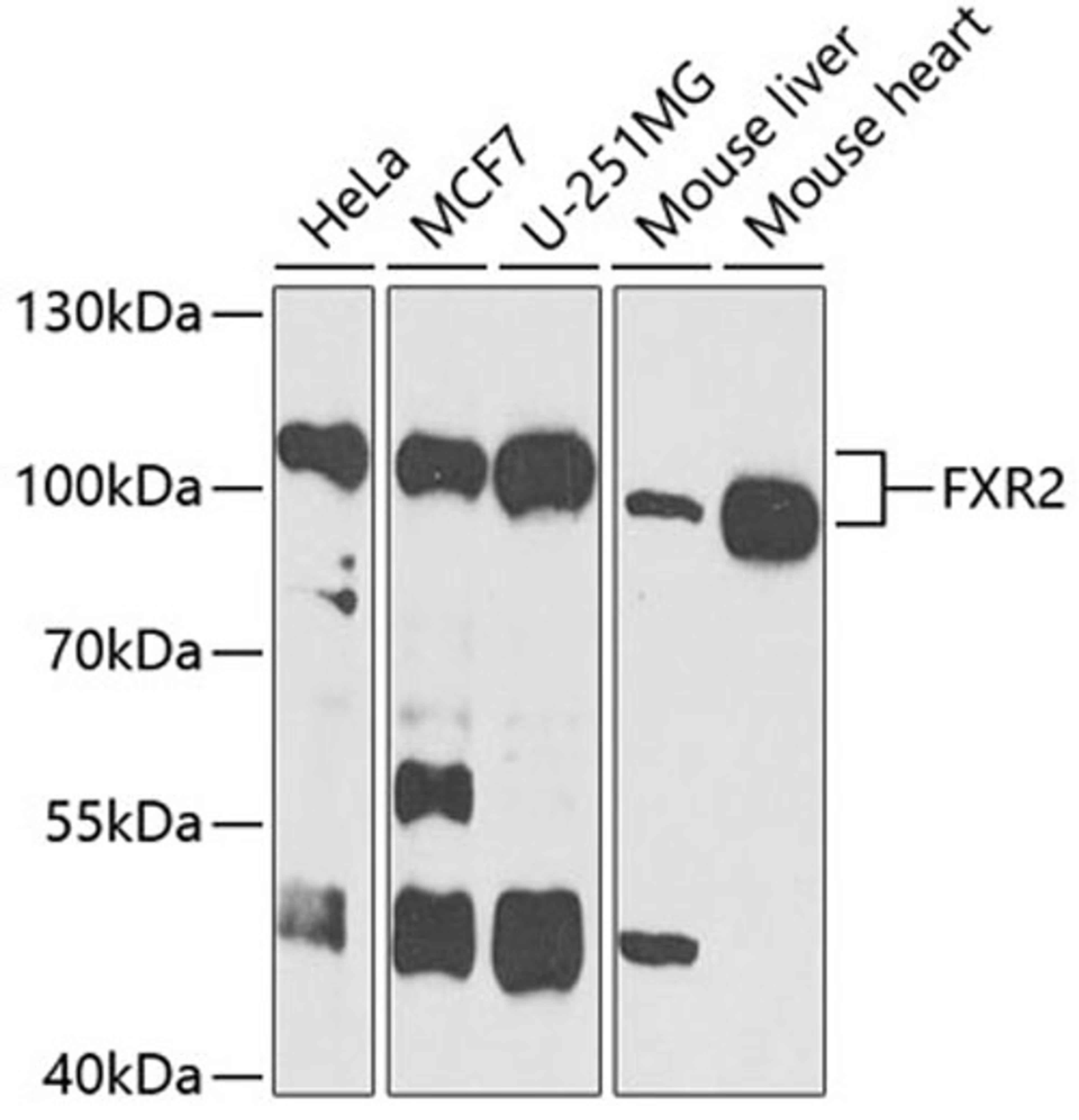 Western blot - FXR2 antibody (A4313)