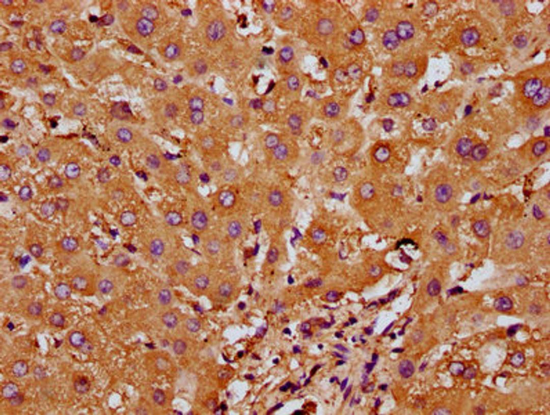 IHC image of CSB-PA835694LA01HU diluted at 1:200 and staining in paraffin-embedded human liver tissue performed on a Leica BondTM system. After dewaxing and hydration, antigen retrieval was mediated by high pressure in a citrate buffer (pH 6.0). Section was blocked with 10% normal goat serum 30min at RT. Then primary antibody (1% BSA) was incubated at 4&deg;C overnight. The primary is detected by a biotinylated secondary antibody and visualized using an HRP conjugated SP system.