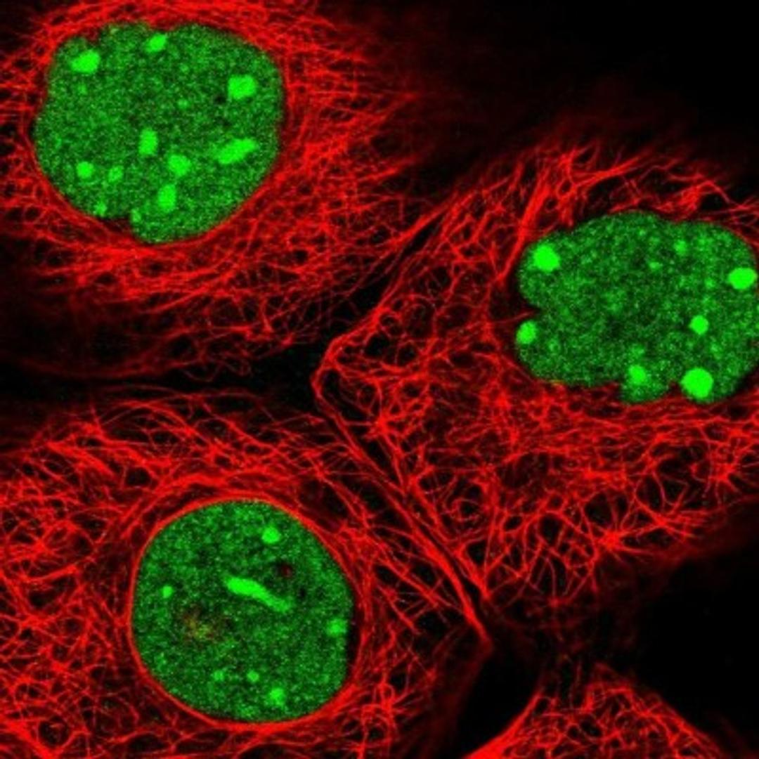 Immunofluorescence: FAM32A Antibody [NBP2-30704] - Immunofluorescent staining of human cell line A-431 shows positivity in nucleus & nucleoli.