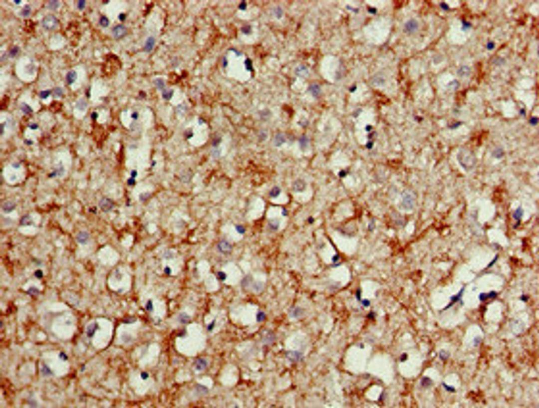 Immunohistochemistry of paraffin-embedded human brain tissue using CSB-PA21109A0Rb at dilution of 1:100