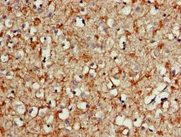Immunohistochemistry of paraffin-embedded human brain tissue using CSB-PA21109A0Rb at dilution of 1:100