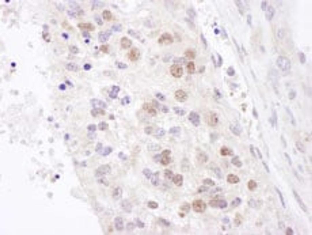 Detection of mouse NF90 and NF110 by immunohistochemistry.