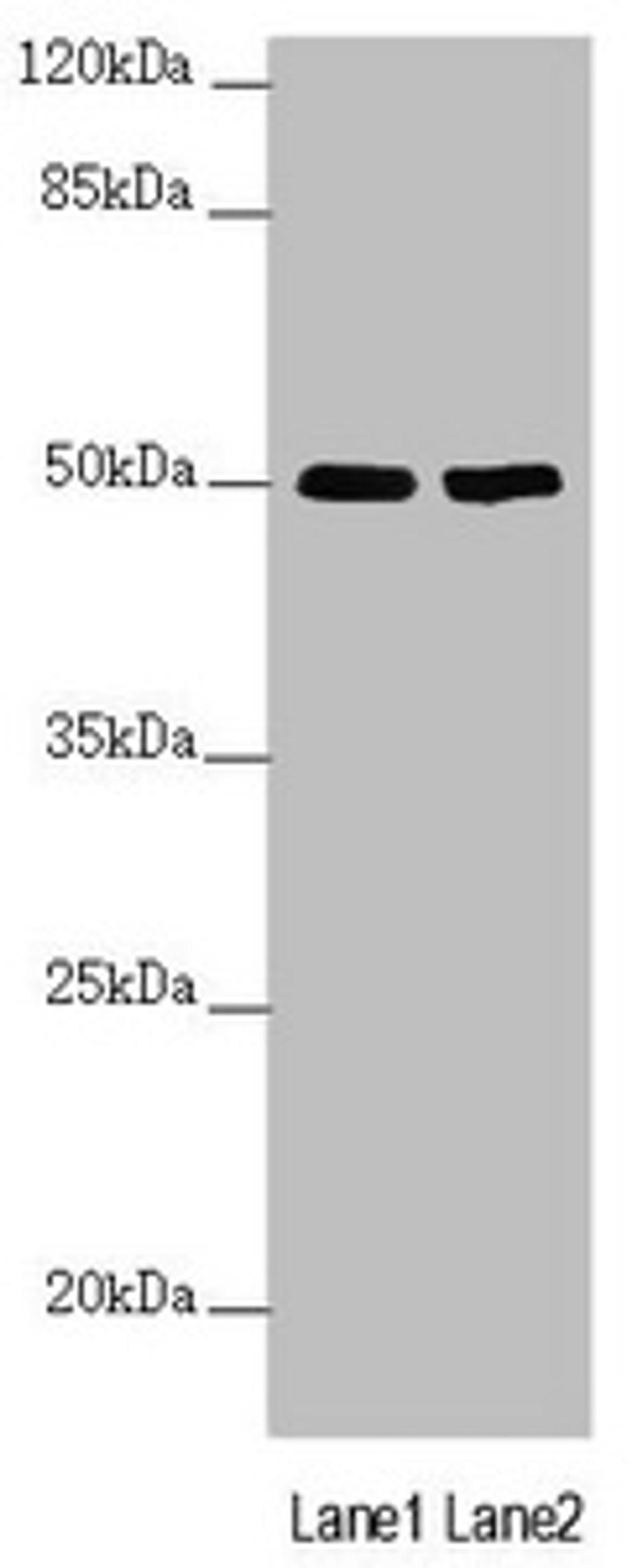 Western blot. All lanes: SLC39A7 antibody at 3.59µg/ml. Lane 1: MCF-7 whole cell lysate. Lane 2: HepG2 whole cell lysate. Secondary. Goat polyclonal to rabbit IgG at 1/10000 dilution. Predicted band size: 51 kDa. Observed band size: 51 kDa