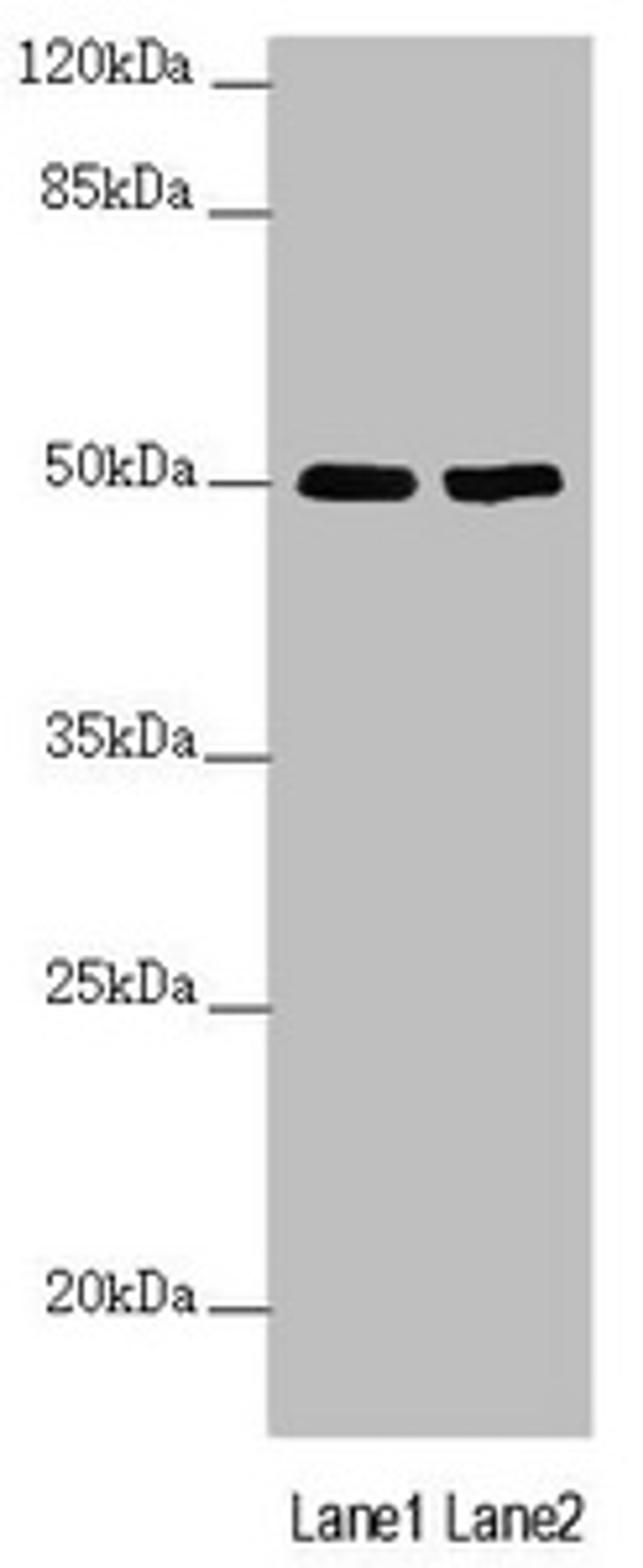 Western blot. All lanes: SLC39A7 antibody at 3.59µg/ml. Lane 1: MCF-7 whole cell lysate. Lane 2: HepG2 whole cell lysate. Secondary. Goat polyclonal to rabbit IgG at 1/10000 dilution. Predicted band size: 51 kDa. Observed band size: 51 kDa