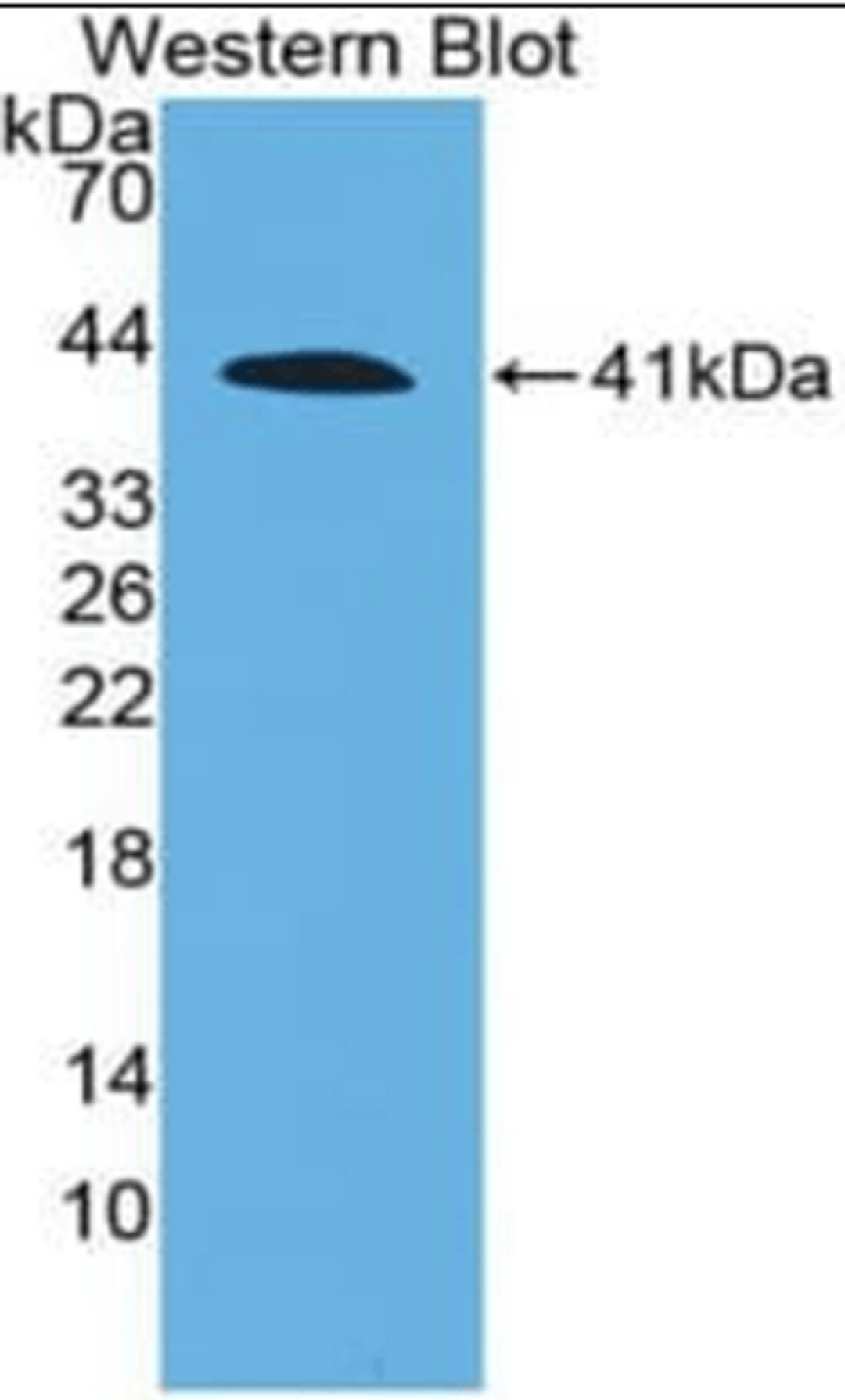 Western blot analysis of recombinant C4 using C4A antibody