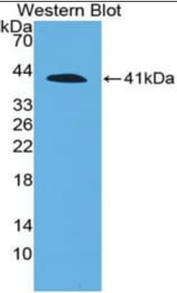 Western blot analysis of recombinant C4 using C4A antibody